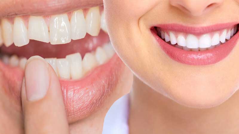 The Best Dental Implants In West Houston: Are West Houston Dental Implants The Ideal Solution For You?
