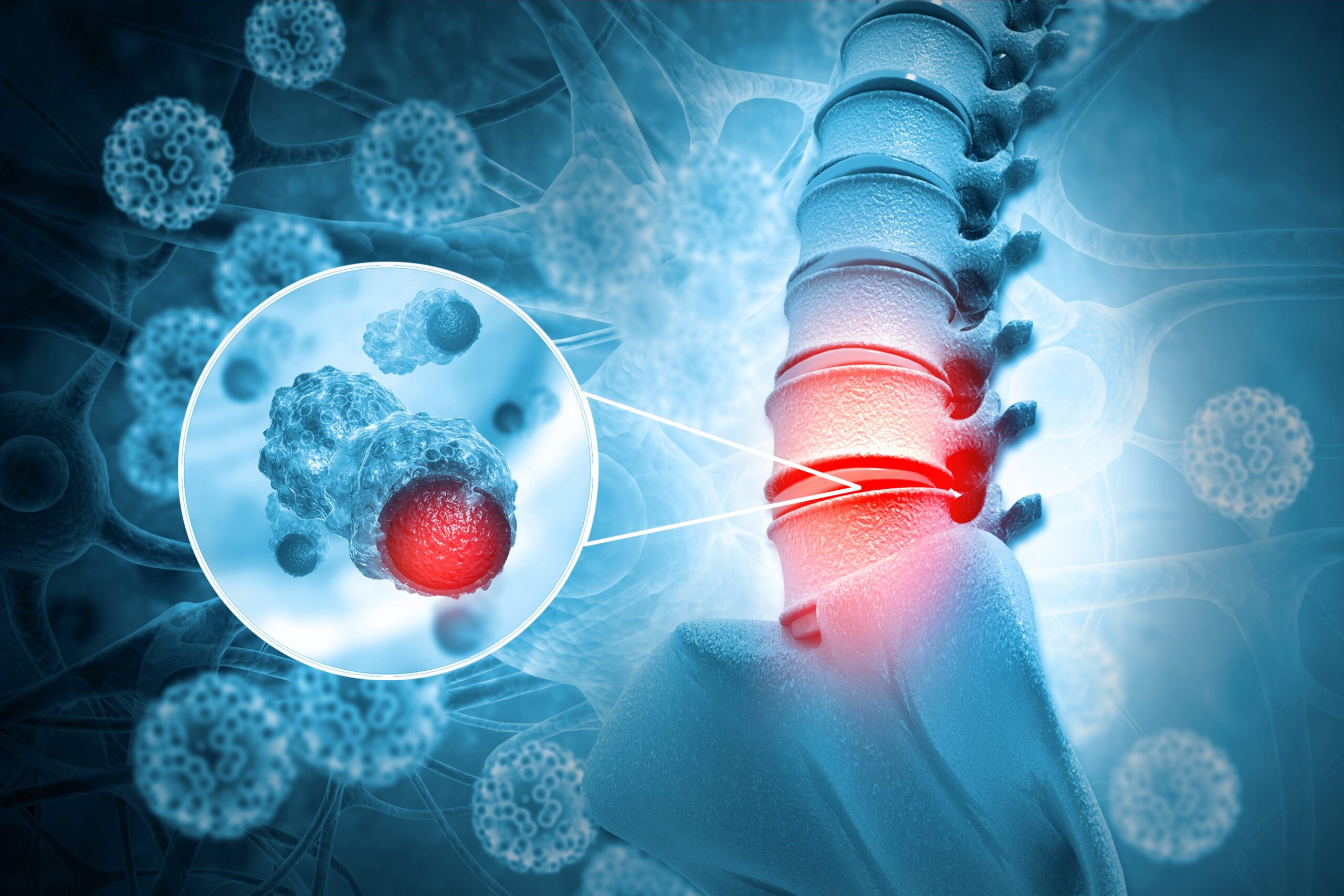 Market Momentum: Bone Cancer Research Analysis and Trends | DLI