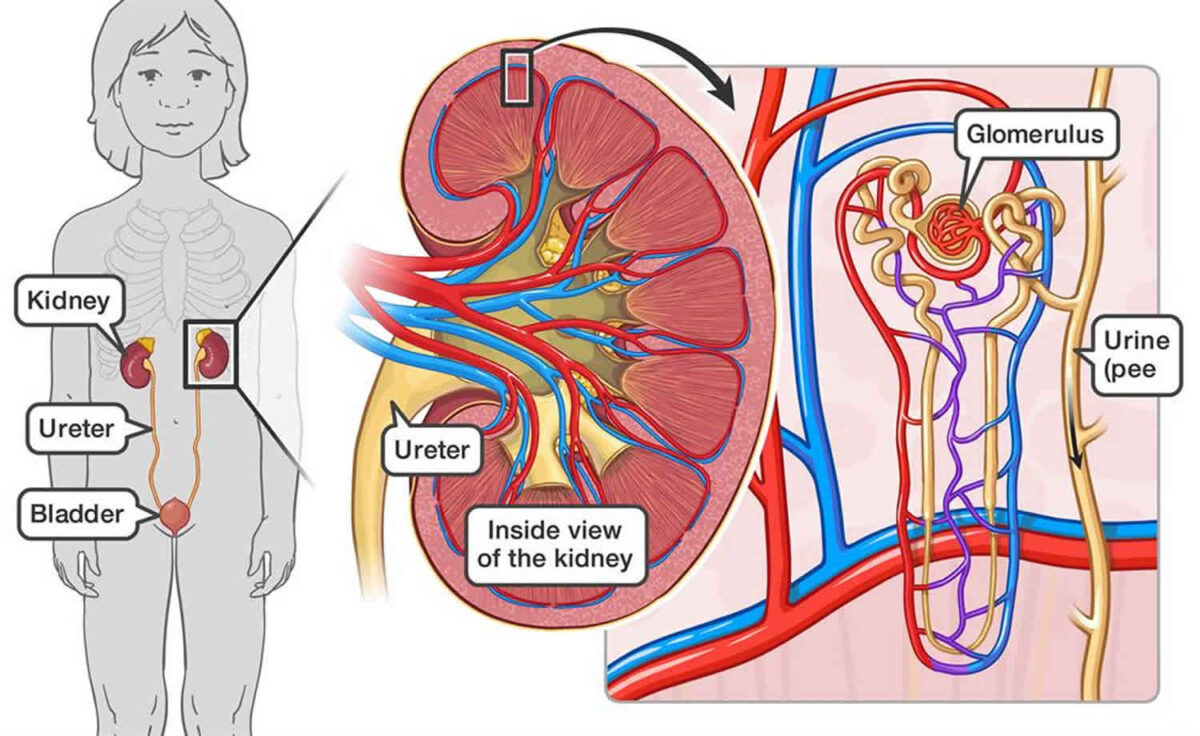 Market Analysis for Glomerulonephritis Disease: Unraveling Treatment Strategies | DLI