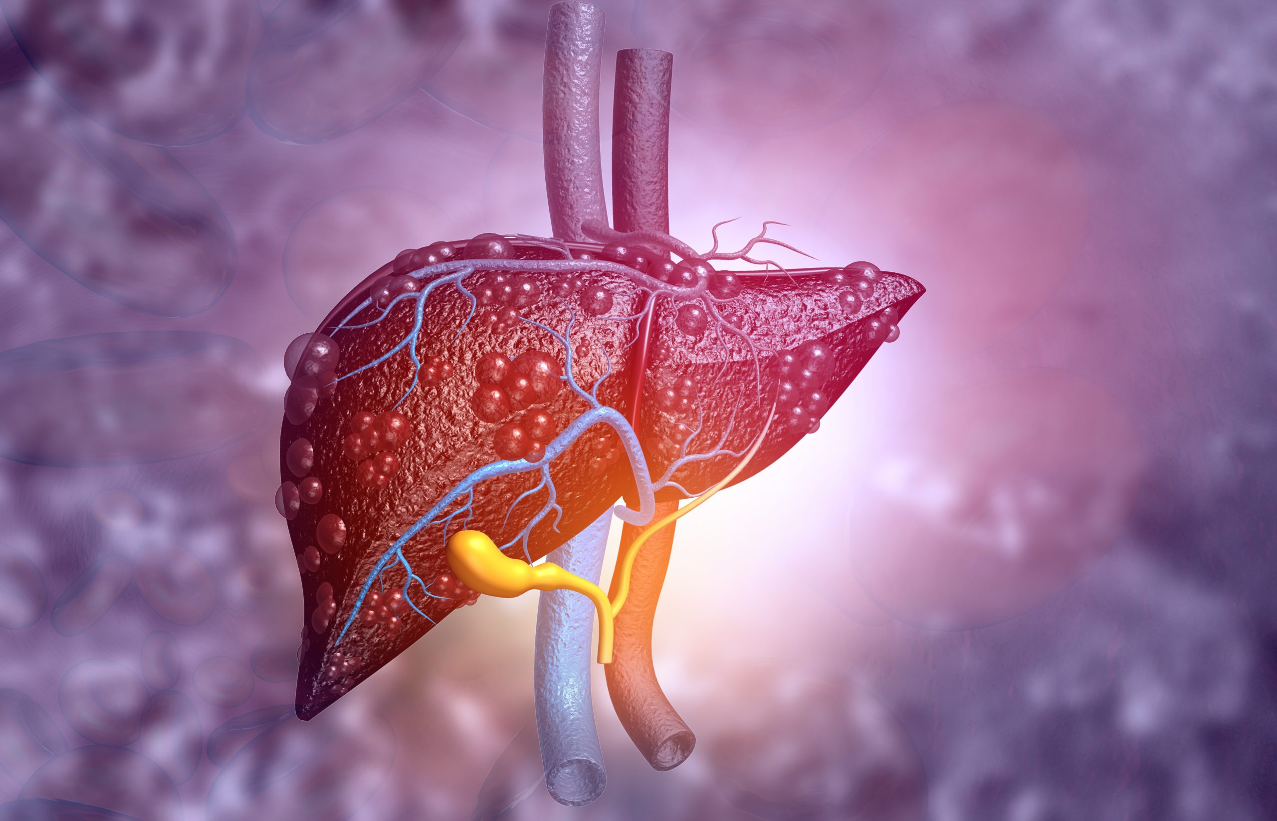 Unlocking Success: Liver Cancer Treatment, Analysis, and Future Insights | DLI